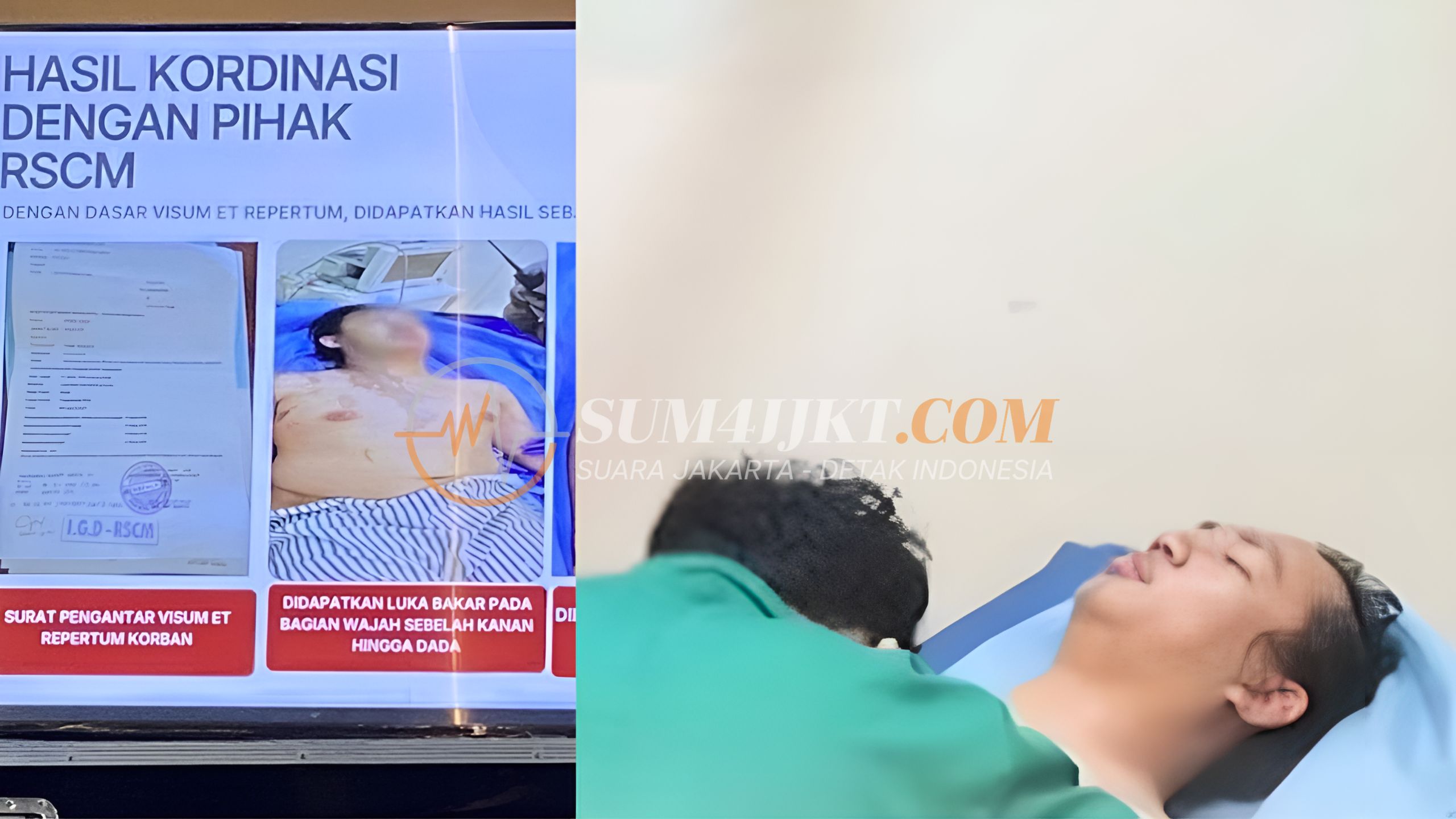 Perkembangan Kondisi Andrie Yunus RSCM