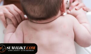 Penyakit Kulit pada Anak yang Perlu Diwaspadai, Kenali Penyebabnya